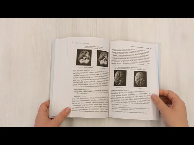 Книга Конец психическим заболеваниям. Революционное исследование, которое поможет укрепить ментальное здоровье и улучшить настроение (Дэниэл Дж. Амен) — 3